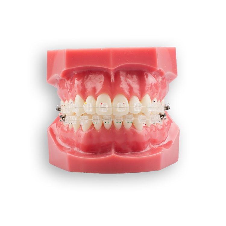 Sapphire Bracket Patient Kit