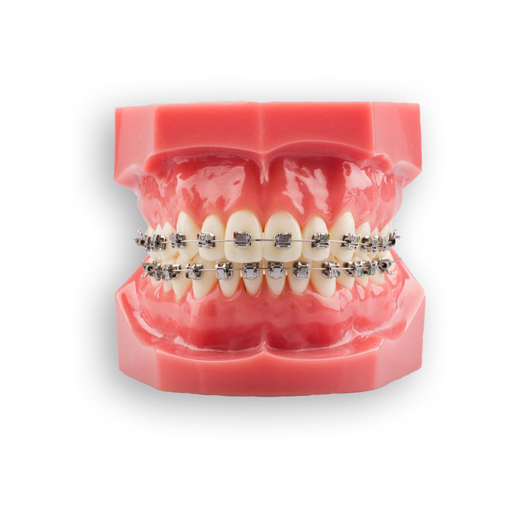 SL Bracket PIV Patient Kit
